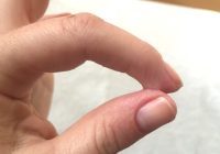 tips buang super glue (1)